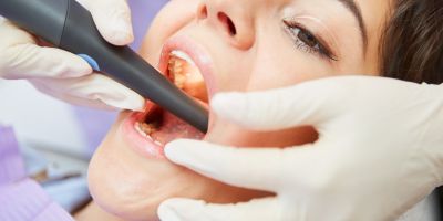Root Canal Treatment